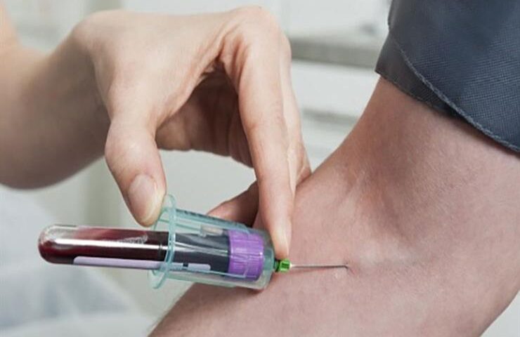 قبل إنهاء خدمتك.. تعرف على حقوقك وإجراءات تحليل المخدرات في قانون 73 لسنة 2021