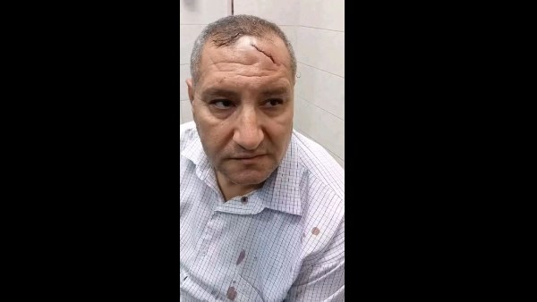 فتحله دماغه| ضبط ولي الأمر المعتدي على مدير مدرسة الدقهلية وإحالته للنيابة العامة