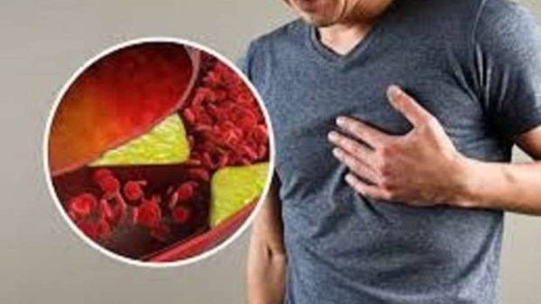 لازم تعرفها.. أهم 5 فيتامينات لعلاج ارتفاع الكوليسترول