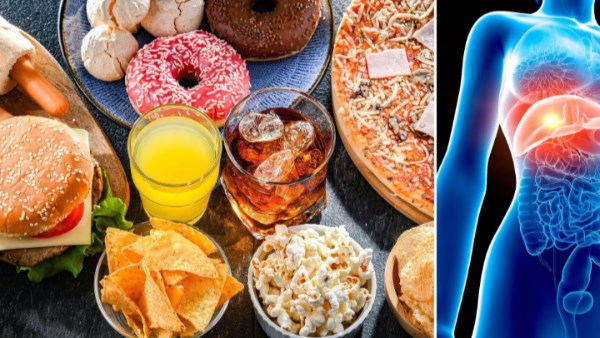 أحذر قبل الأكل .. هذه الأطعمة تسبب دهون الكبد..ماذا تفعل؟