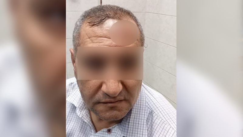 17 غرزة، ضبط ولي أمر بتهمة التعدي على مدير مدرسة ميت الفرماوي بالدقهلية