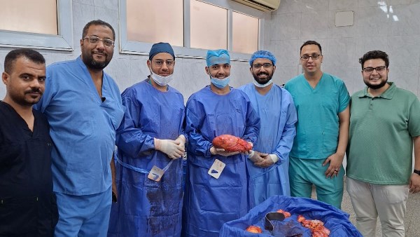 فريق طبي بجامعة أسيوط ينجح في استئصال ورم خبيث نادر وزنه 10 كيلوجرامات