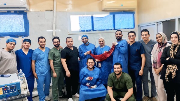 أعاد القولون والطحال والكلية إلى البطن.. فريق طبي بجامعة أسيوط ينقذ مريضًا