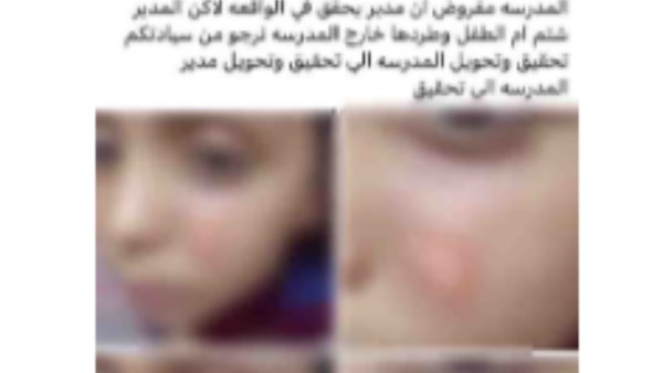 مدير المدرسة طرد أهله.. القبض على مدرسة حرقت وجه طالب بسوهاج