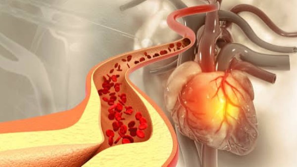 تناول هذه الأنواع من الخضروات يساعد على خفض الكوليسترول