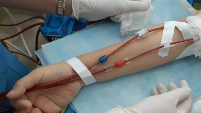 الصحة تحذر مرضى الغسيل الكلوي: هذه الأعراض تستدعي إبلاغ الطبيب