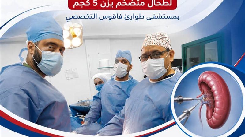 استئصال طحال متضخم لمريض 59 عامًا في عملية جراحية دقيقة بطوارئ فاقوس