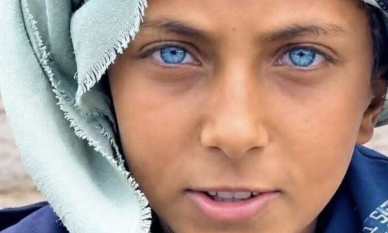 طفل يمني يتصدر الترند.. بعيون زرقاء فاتحة سحرت الإنترنت