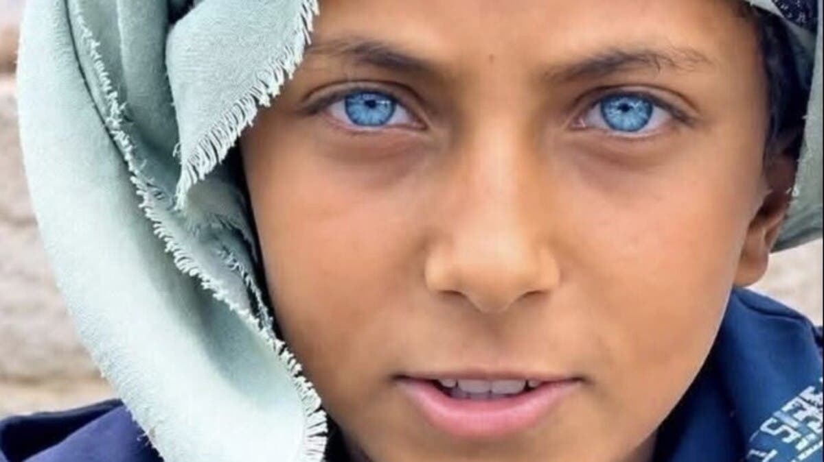 طفل يمني يتصدر الترند.. بعيون زرقاء فاتحة سحرت الإنترنت