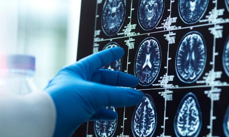 علماء يكتشفون أن الدماغ البشري يتكون في الواقع من عضوين منفصلين