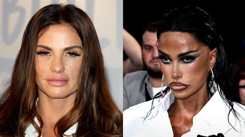 كاتي برايس تصدم جمهورها بعد جراحة تجميل جديدة قبل ظهورها في حفل NTA (صور)