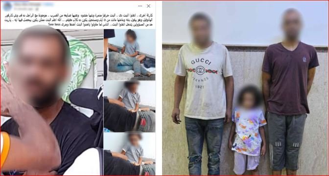 ابنة زوجته المتوفاة ويستغلها في التسول.. ضبط المتهم بالتعدي على طفلة بالضرب بالإسكندرية