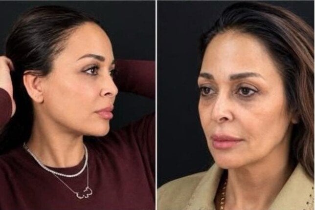 داليا البحيري تتصدر التريند بعد نجاح عملية التجميل.. كيف بدت في آخر ظهور؟