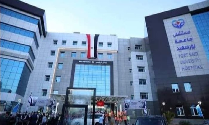 جامعة بورسعيد تُطلق مبادرة للكشف المبكر عن ارتفاع ضغط العين «المياه الزرقاء»