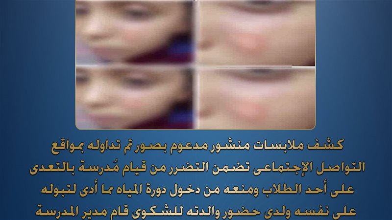 “منعته من دخول الحمام حتى بال على نفسه”، ضبط معلمة حرقت وجه تلميذ بـ”بولاعة” في سوهاج