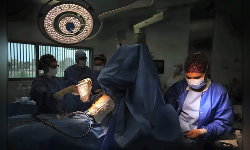 دراسة: استئصال الزائدة الدودية الملتهبة قد يقلل خطر الإصابة بسرطان القولون