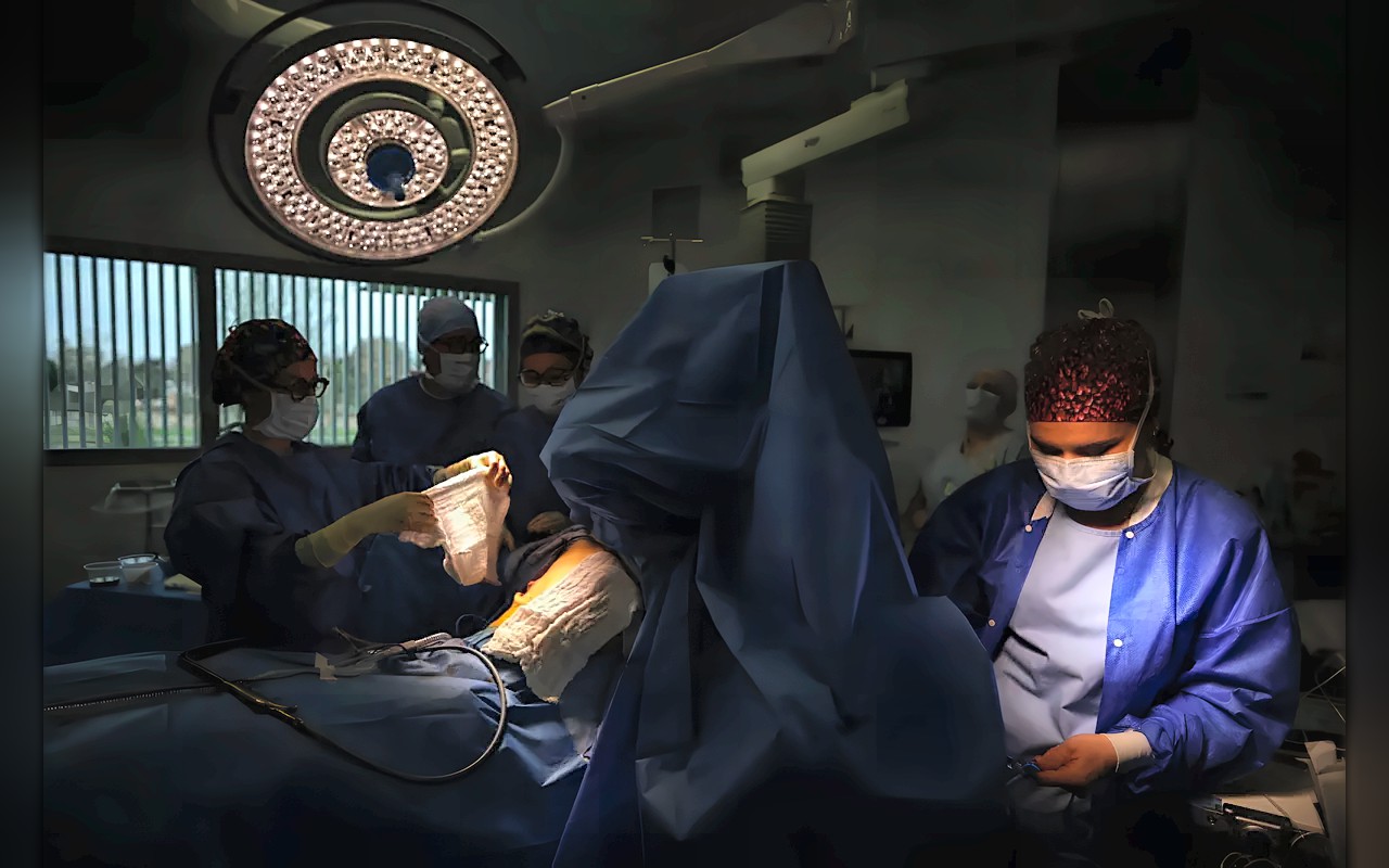 دراسة: استئصال الزائدة الدودية الملتهبة قد يقلل خطر الإصابة بسرطان القولون