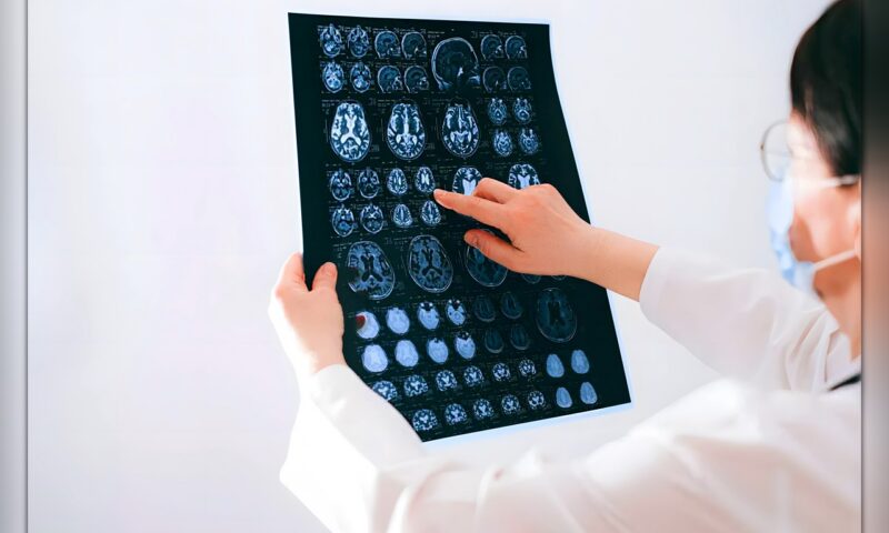 دراسة حديثة: الدماغ البشري ليس عضواً واحداً بل اثنان!