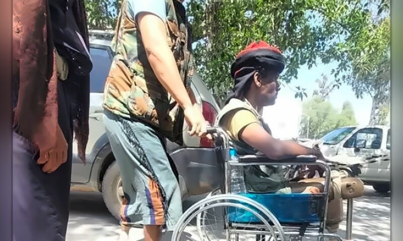 جرحى حوثيون يعودون من الجبهات إلى خانة الإهمال