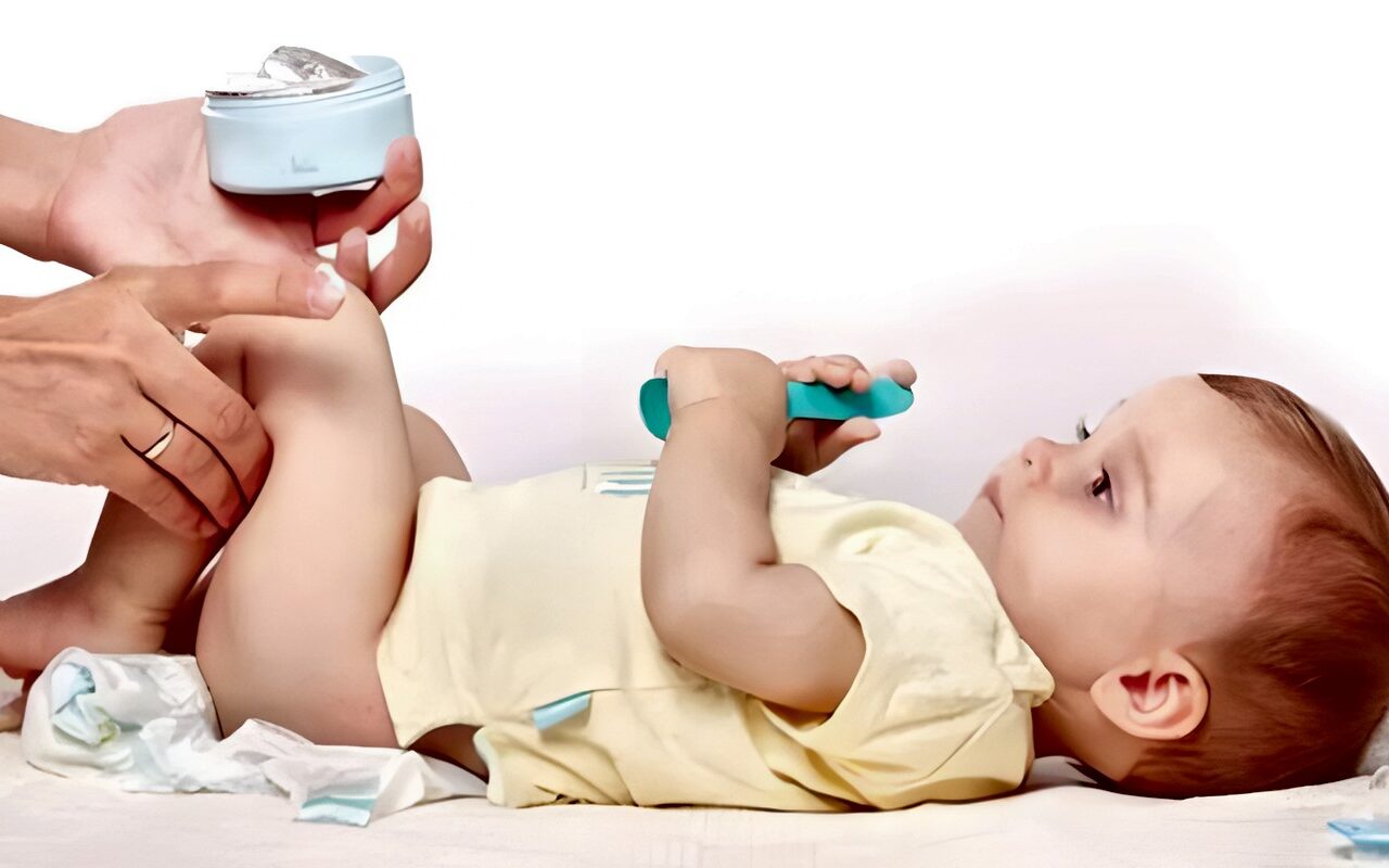كيف تختار الأم كريم الحفاضات؟.. نصائح من استشارية طب الأطفال
