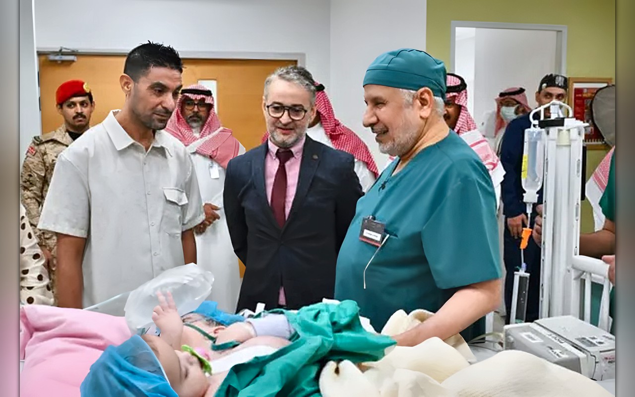 نجاح عملية فصل التوأم الملتصق المغربي «سجى وضحى»