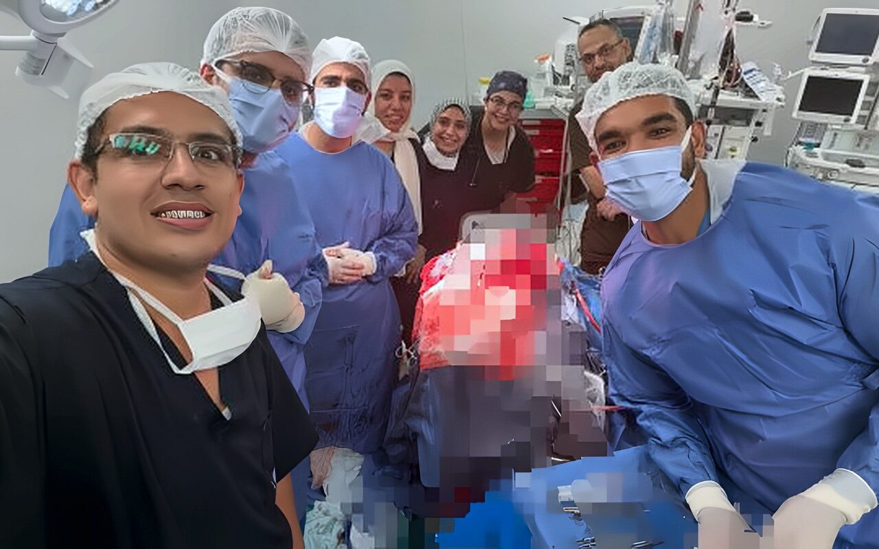 أطباء قصر العيني ينجحون في إنقاذ مريض باستخراج مسمار من الجمجمة بالقرب من شرايين المخ