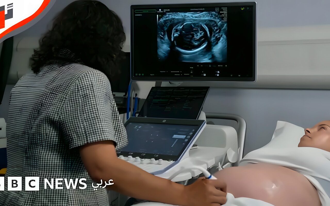 الذكاء الاصطناعي يدعم فحوصات الموجات فوق الصوتية للجنين
