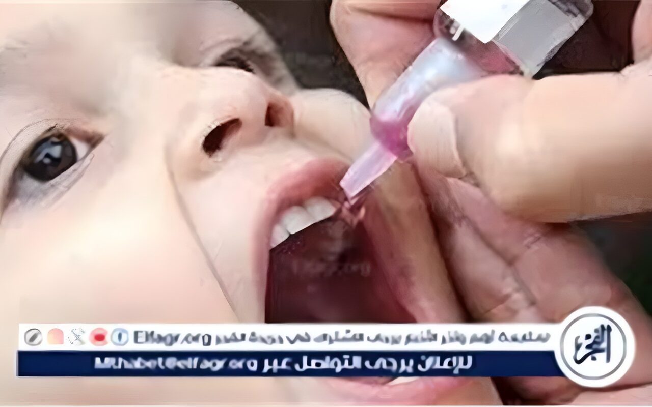 استشاري أطفال يوضح الأعراض المتوقعة بعد تطعيم الحصبة الألمانية للأطفال
