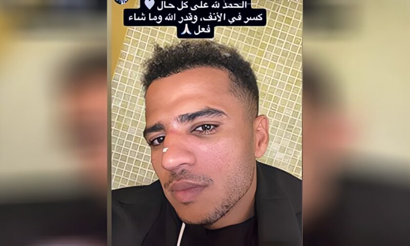 أحمد ربيع يعلن إصابته بكسر فى الأنف بعد مباراة الزمالك والجيش الرواندي