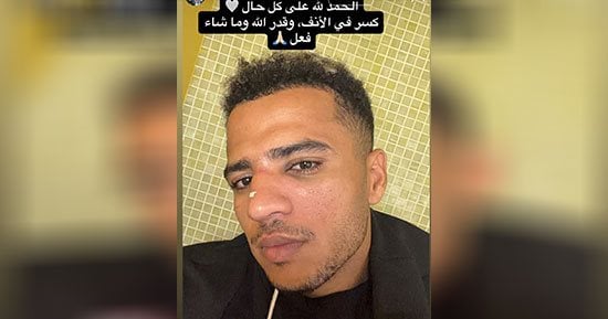 أحمد ربيع يعلن إصابته بكسر فى الأنف بعد مباراة الزمالك والجيش الرواندي