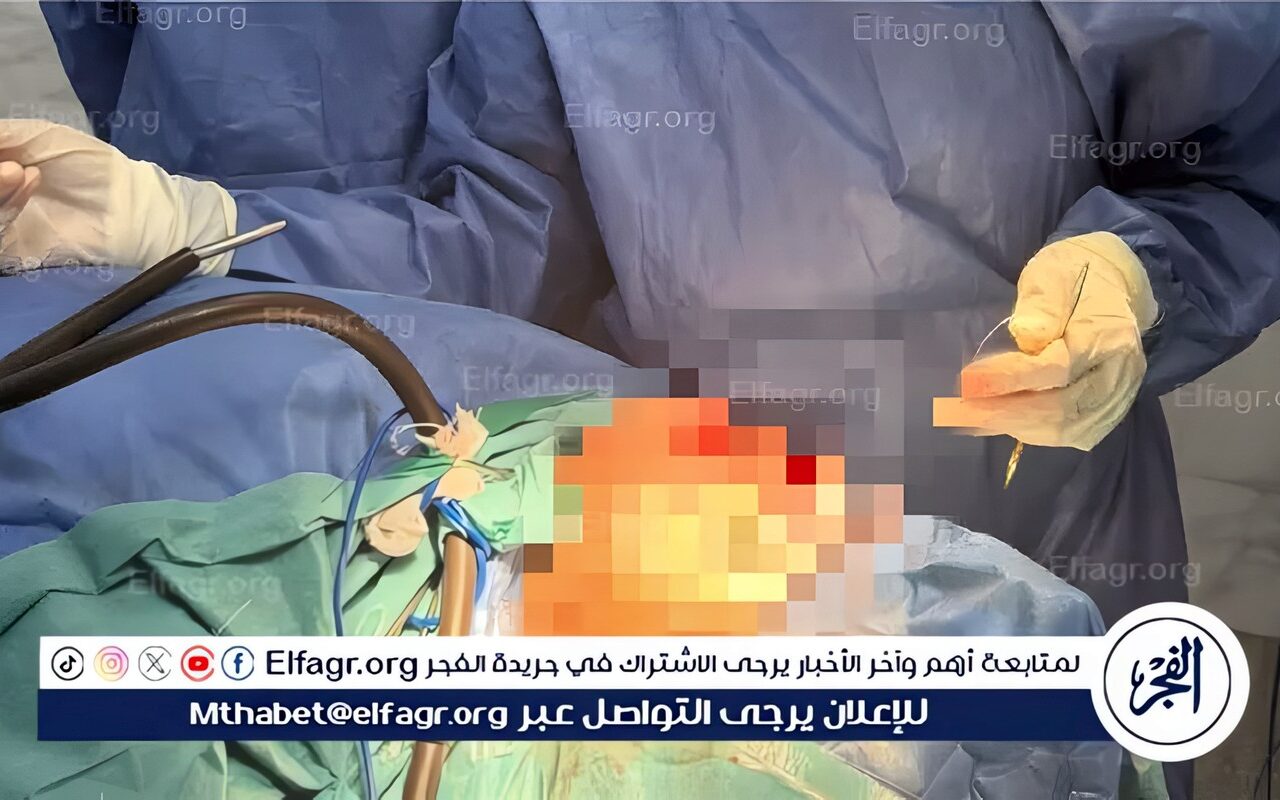 نجاح جراحة لتثبيت كسور عظام الوجه والفكين لمصاب بحادث سير بمستشفى الإيمان العام بأسيوط
