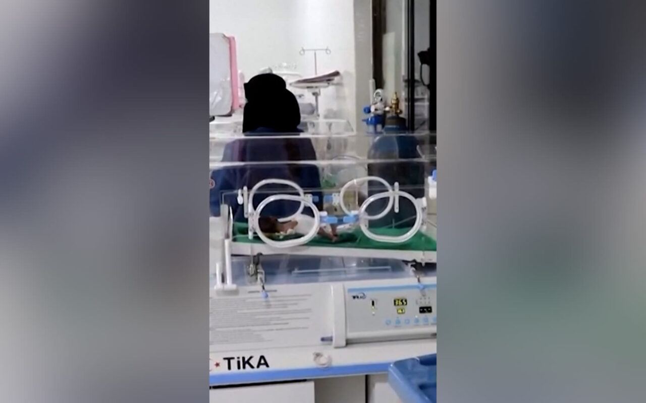 في اليمن.. نساء يواجهن خطر الموت أثناء الولادة دون رعاية طبية