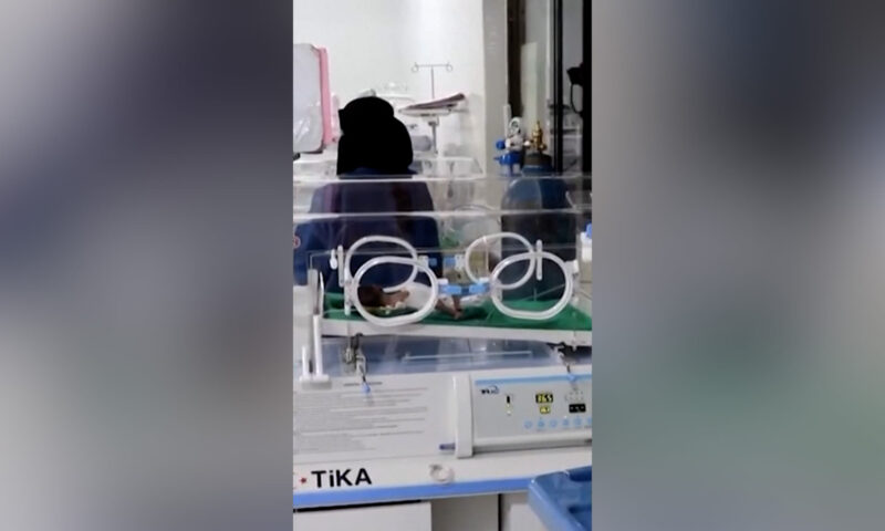 في اليمن.. نساء يواجهن خطر الموت أثناء الولادة دون رعاية طبية