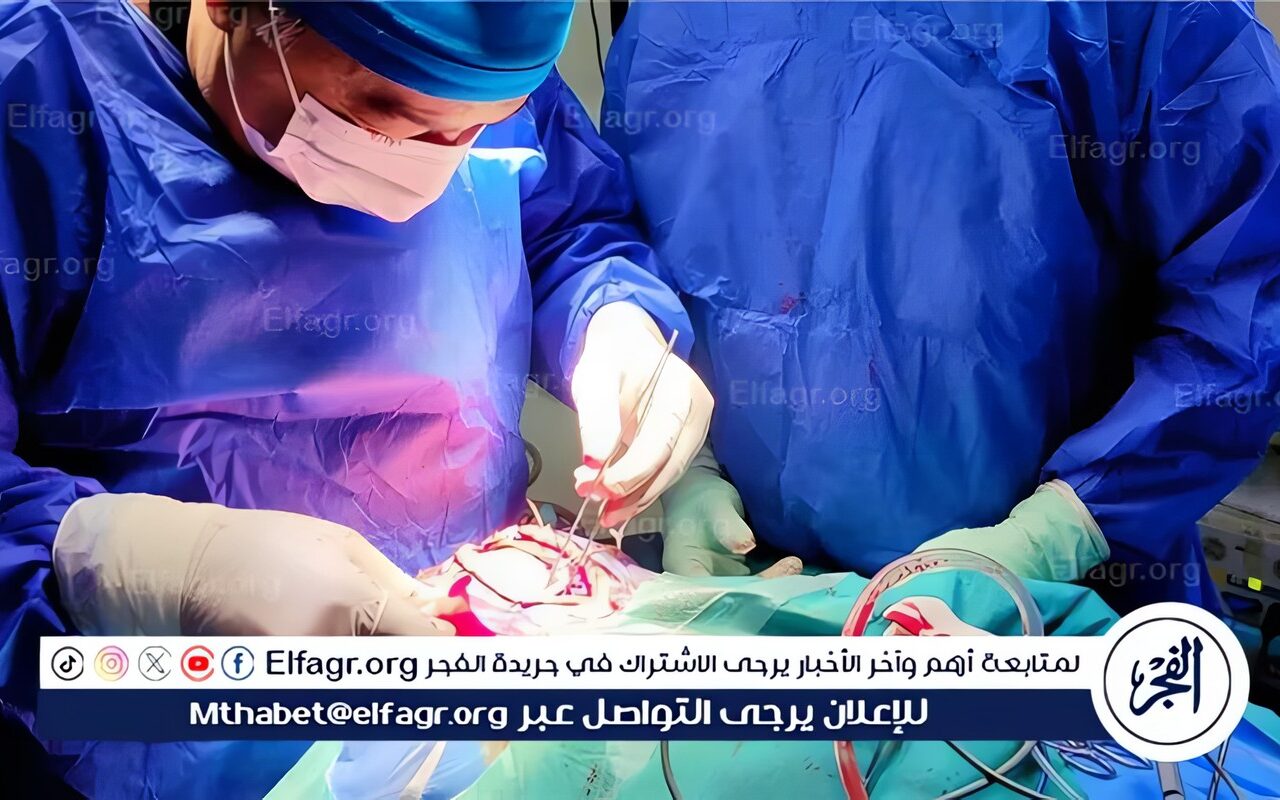 جامعة أسيوط تنجح في علاج تشوه شرياني وريدي نادر بفروة رأس طفلة بجراحة دقيقة