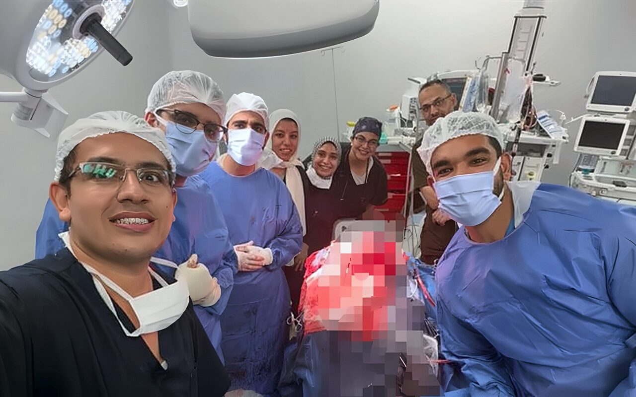 قرب شرايين المخ الرئيسية، أطباء طوارئ قصر العينى يستخرجون مسمارا من عظام جمجمة مريض