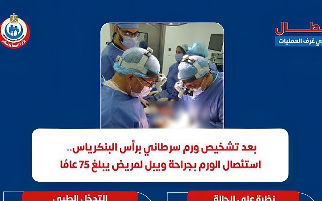 نجاح جراحة دقيق لإزالة ورم سرطاني لمريض بمستشفي المقطم