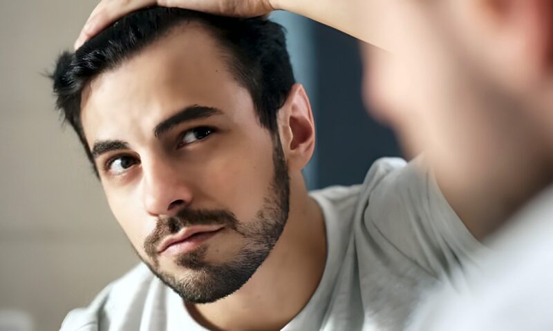 الوراثة أم التوتر؟.. لهذه الأسباب تساقط الشعر شائع بين الرجال في سن مبكرة