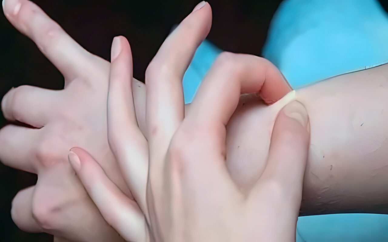 السنط الجلدي.. كل ما تريد معرفته عن أسبابه وطرق انتقاله وعلاجه