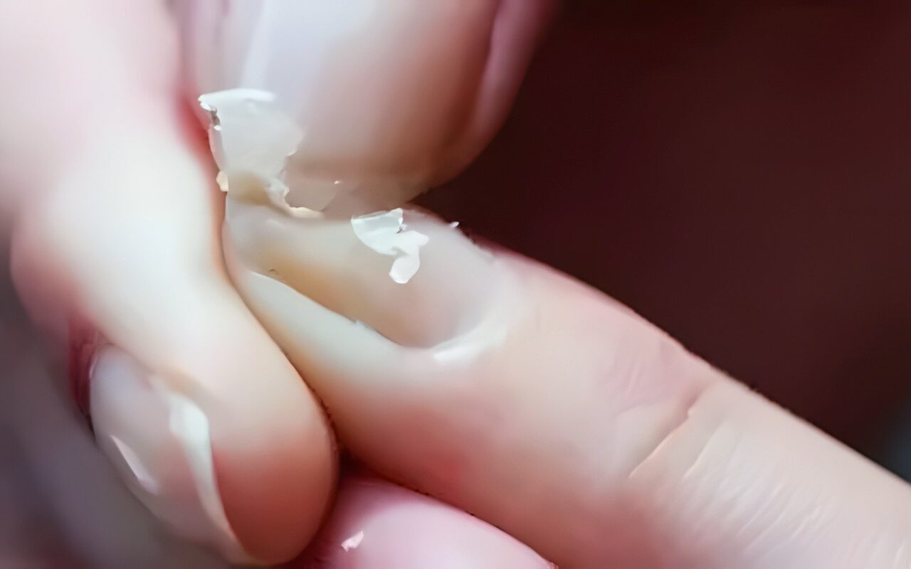 أعراض تكشف وجود نقص بالكالسيوم.. استشاري يوضح