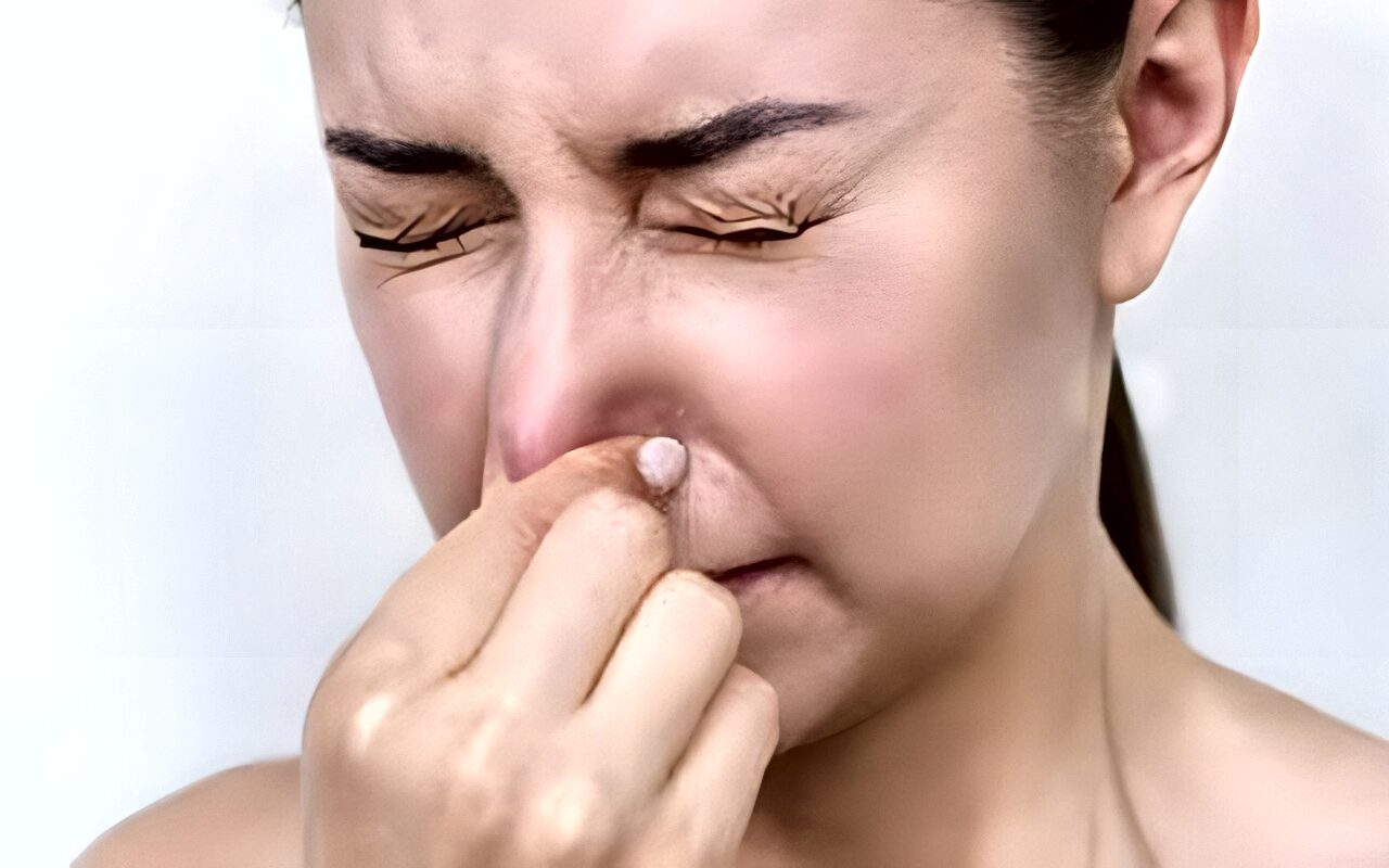 ماذا يحدث للجسم عند حبس العطس؟