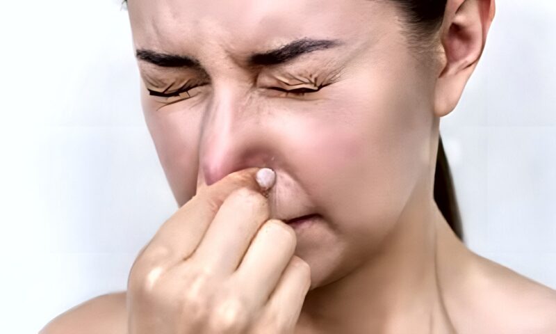 ماذا يحدث للجسم عند حبس العطس؟