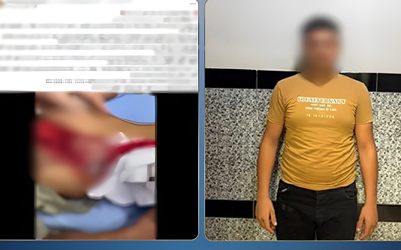 تعدى على طفلين بالضرب وأصاب أحدهما بقطعة زجاج.. وهذه عقوبة المتهم