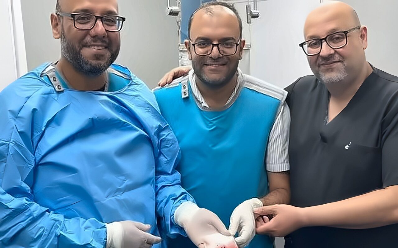 نجاح قسطرة مخية لعلاج انسداد الشريان القاعدي وإنقاذ مريض خلال 30 دقيقة