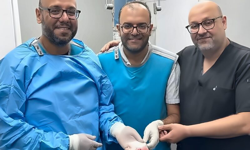 نجاح قسطرة مخية لعلاج انسداد الشريان القاعدي وإنقاذ مريض خلال 30 دقيقة