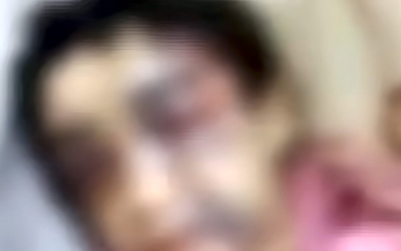 لجنة حمايةالطفل تفحص حالتها النفسية. تطورات واقعة تعذيب منة في الإسكندرية