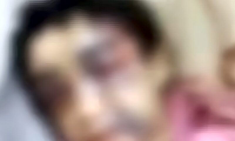 لجنة حمايةالطفل تفحص حالتها النفسية. تطورات واقعة تعذيب منة في الإسكندرية