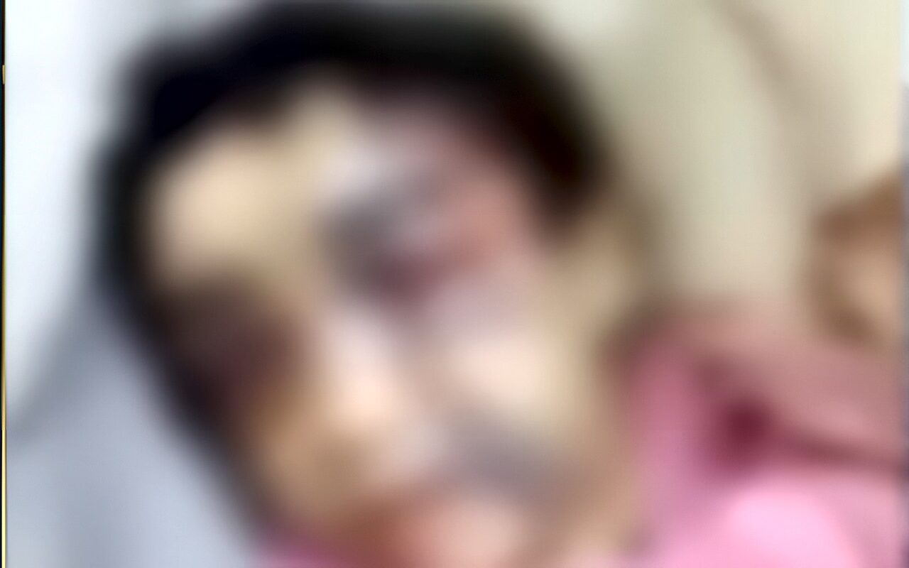 تحسن الحالة الصحية للطفلة منة ضحية الاعتداء عليها من والدها بالإسكندرية