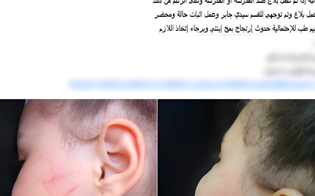 معندهاش رحمه.. القبض على مدرسة تعدت على تلميذة بالضرب داخل مدرسة بالإسكندرية
