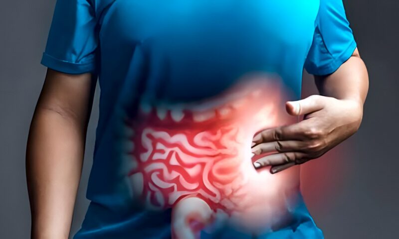 أعراض القولون العصبي.. 7 علامات شائعة تكشف الإصابة