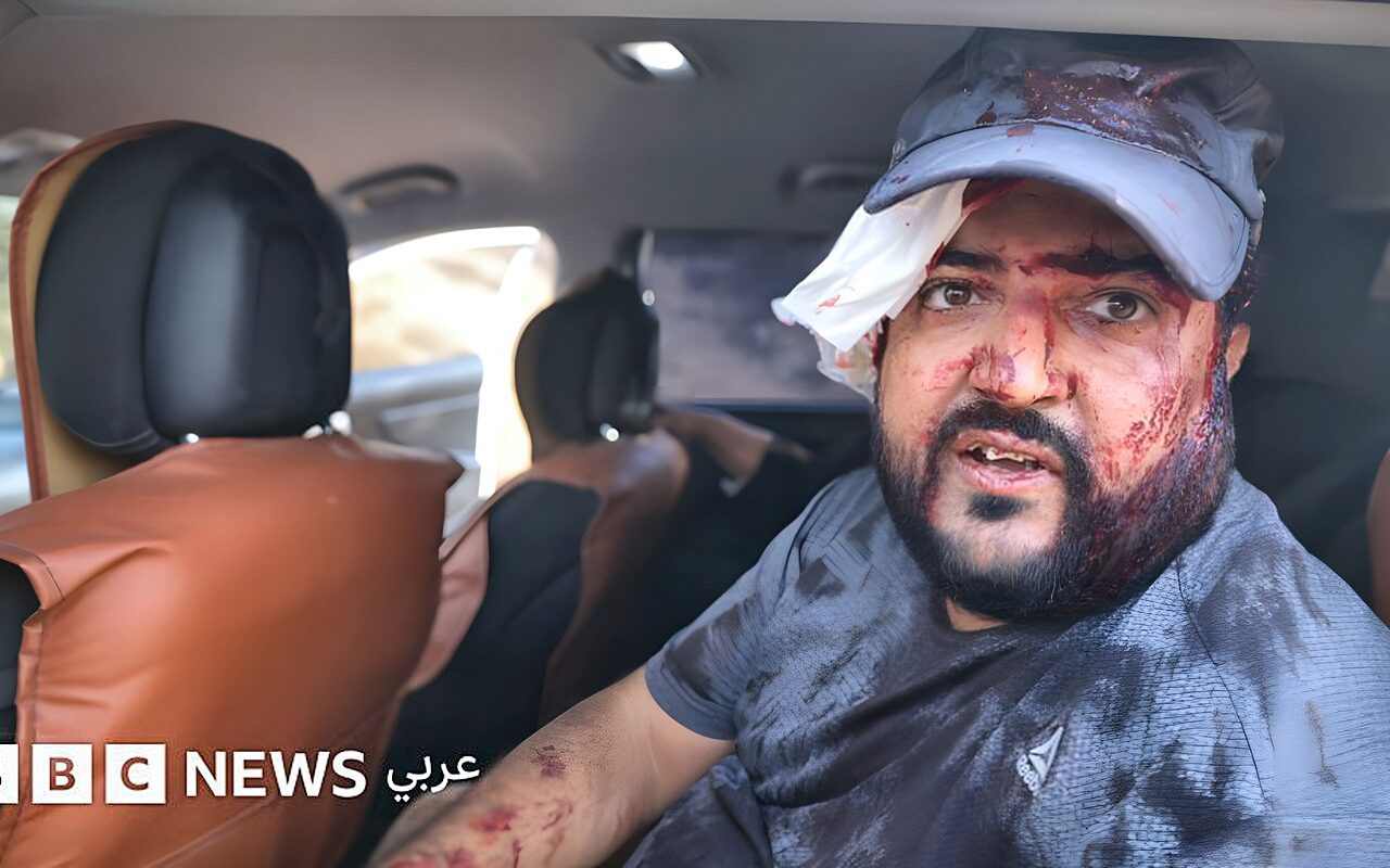 إصابة فلسطينيين وصحافية أمريكية في هجوم لمستوطنين إسرائيليين خلال قطف الزيتون بالضفة الغربية المحتلة